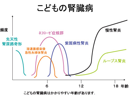 こどもの腎臓病はかかりやすい年齢があります。 先天性腎尿路奇形、溶連菌感染後急性糸球体腎炎、ネフローゼ症候群、紫斑病性腎炎、慢性腎炎、ループス腎炎