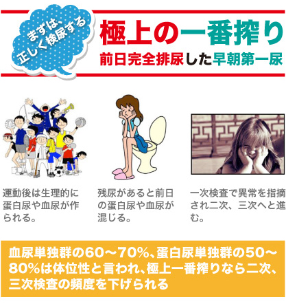 まずは正しく検尿する 運動後は生理的に蛋白尿、血尿がつくられる。残尿があると前日の蛋白尿や血尿が混じる。 一次検査で異常を指摘され二次、三次へと進む。血尿単独群の60~70%、蛋白尿単独群の50~80%は体位性といわれ、極上一番搾りなら二次、三次検査の頻度を下げられます。